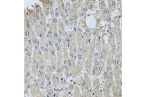 Immunohistochemistry of paraffin-embedded human liver injury using SYT11 antibody at dilution of 1:100 (x40 lens). (SYT11 抗体)