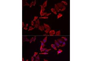 Immunofluorescence analysis of MCF7 cells using SKAP2 Polyclonal Antibody (SKAP2 抗体)