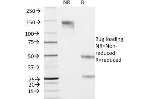 SDS-PAGE (SDS) image for anti-Keratin 19 (KRT19) antibody (ABIN6939946)