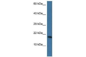 Western Blot showing Pnkd antibody used at a concentration of 1. (PNKD 抗体  (N-Term))