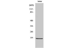 Western Blotting (WB) image for anti-Caspase 2 p18 (Cleaved-Gly170) antibody (ABIN5955971) (Caspase 2 p18 抗体  (Cleaved-Gly170))