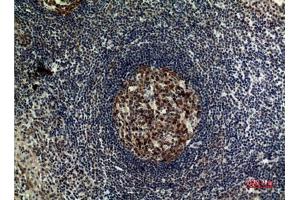 Immunohistochemical analysis of paraffin-embedded human-tonsilla, antibody was diluted at 1:100. (FOXP3 抗体  (C-Term))