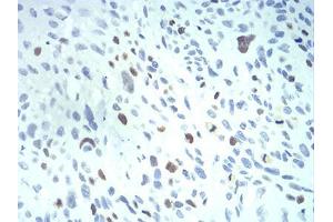 Immunohistochemistry (IHC) image for anti-Karyopherin alpha 2 (RAG Cohort 1, Importin alpha 1) (KPNA2) (AA 1-530) antibody (ABIN5542626)