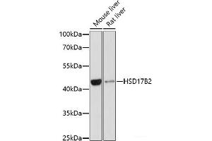Western blot analysis of extracts of various cell lines using HSD17B2 Polyclonal Antibody at dilution of 1:1000. (HSD17B2 抗体)