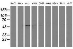 Image no. 3 for anti-Adaptor-Related Protein Complex 2, mu 1 Subunit (AP2M1) (AA 97-383) antibody (ABIN1491721) (AP2M1 抗体  (AA 97-383))