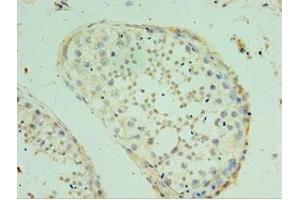 Immunohistochemistry of paraffin-embedded human testis tissue using ABIN7170476 at dilution of 1:100 (SPAG16 抗体  (AA 1-183))