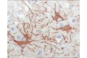 Immunohistochemistry (IHC) image for anti-Feline Sarcoma Oncogene (FES) (truncated) antibody (ABIN2464051) (FES 抗体  (truncated))
