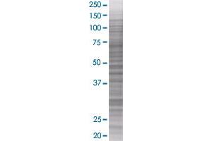 Western Blotting (WB) image for FCGR2B 293T Cell Transient Overexpression Lysate(Denatured) (ABIN1331801)