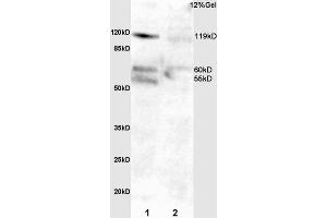 L1 mouse intestine lysate L2 rat lung lysates probed with Anti Phospho-FAK (Tyr397)Polyclonal Antibody, Unconjugated  at 1:3000 for 90 min at 37˚C. (FAK 抗体  (pTyr397))