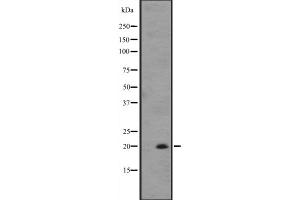 Western blot analysis of IL25 expression in ZR-75-1 cell line lysates ,The lane on the left is treated with the antigen-specific peptide. (IL-25 抗体  (Internal Region))