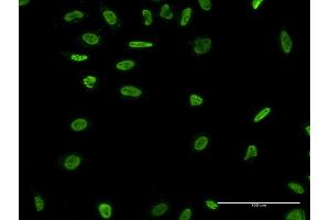 Immunofluorescence of monoclonal antibody to RAD18 on HeLa cell. (RAD18 抗体  (AA 332-430))