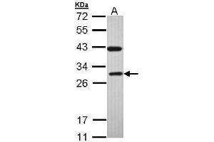 WB Image Sample (30 ug of whole cell lysate) A: H1299 12% SDS PAGE antibody diluted at 1:1000 (Rab3c 抗体)