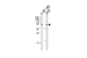 Western blot analysis of lysates from U-251 MG, 293T cell line (from left to right), using CPM Antibody at 1:1000 at each lane. (CPM 抗体  (AA 212-241))