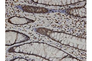 Immunostaining (ISt) image for anti-CTD (Carboxy-terminal Domain, RNA Polymerase II, Polypeptide A) Phosphatase, Subunit 1 (CTDP1) (AA 332-431) antibody (ABIN522613)