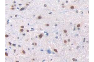 IHC-P analysis of Rat Spinal cord Tissue, with DAB staining. (Renin 抗体  (AA 275-389))
