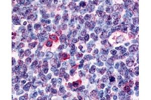 Anti-GPR146 antibody IHC of human tonsil germinal center. (GPR146 抗体  (Cytoplasmic Domain))