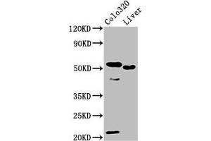 Western Blot Positive WB detected in: Colo320 whole cell lysate, Rat liver tissue All lanes: OLFM4 antibody at 10 μg/mL Secondary Goat polyclonal to rabbit IgG at 1/50000 dilution Predicted band size: 58 kDa Observed band size: 58 kDa (Olfactomedin 4 抗体  (AA 224-334))