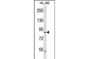 Western Blotting (WB) image for anti-Dynein, Axonemal, Heavy Chain 2 (DNAH2) (AA 440-468), (N-Term) antibody (ABIN5533571)