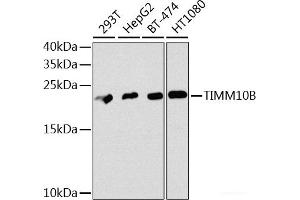 Western blot analysis of extracts of various cell lines using TIMM10B Polyclonal Antibody at dilution of 1:1000. (TIMM10B 抗体)