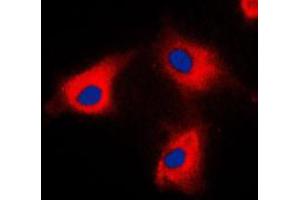Immunofluorescent analysis of BCKDK staining in HeLa cells. (BCKDK 抗体  (N-Term))