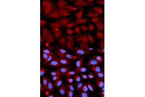 Immunofluorescence analysis of U2OS cell using CD70 antibody. (CD70 抗体  (AA 39-193))
