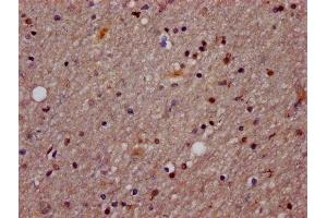 Immunohistochemistry (IHC) image for anti-Argonaute 2 (AGO2) (AA 517-818) antibody (ABIN7165091)