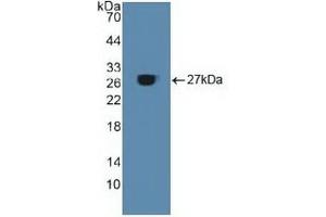 Detection of Recombinant ACO1, Human using Polyclonal Antibody to Aconitase 1 (ACO1) (Aconitase 1 抗体  (AA 251-443))