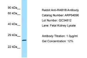 Western Blotting (WB) image for anti-RAB1B, Member RAS Oncogene Family (RAB1B) (C-Term) antibody (ABIN2774390) (RAB1B 抗体  (C-Term))