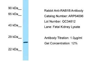 Western Blotting (WB) image for anti-RAB1B, Member RAS Oncogene Family (RAB1B) (C-Term) antibody (ABIN2774390) (RAB1B 抗体  (C-Term))