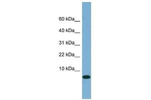 FABP1 antibody used at 1 ug/ml to detect target protein. (FABP1 抗体  (N-Term))