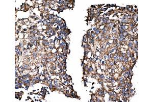 IHC analysis of Paxillin/PXN using anti-Paxillin/PXN antibody (ABIN7602636). (Paxillin 抗体  (AA 9-570))