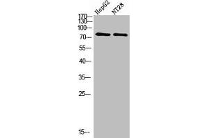 Western Blot analysis of hepg2, NT28 cells using Antibody diluted at 500. (RPS6KA2 抗体  (AA 330-400))