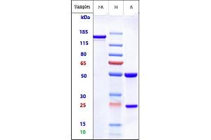 Anti-ROR2 Reference Antibody (Ozuriftamab) on SDS-PAGE under reducing (R) condition. (Recombinant ROR2 (Ozuriftamab Biosimilar) 抗体)