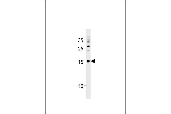 SSNA1 抗体  (N-Term)