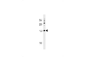 SSNA1 Antibody (N-term) (ABIN1881836 and ABIN2843441) western blot analysis in  cell line lysates (35 μg/lane). (SSNA1 抗体  (N-Term))