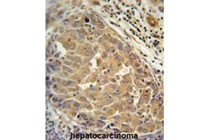 Immunohistochemistry (Paraffin-embedded Sections) (IHC (p)) image for anti-Fibroblast Growth Factor 2 (Basic) (FGF2) (AA 37-66), (Middle Region) antibody (ABIN952306)