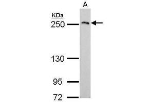WB Image COL3A1 antibody [C2C3], C-term detects COL3A1 protein by Western blot analysis. (COL3A1 抗体  (C-Term))