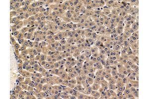 anti-Plasminogen Receptor, C-Terminal Lysine Transmembrane Protein (PLGRKT) antibody