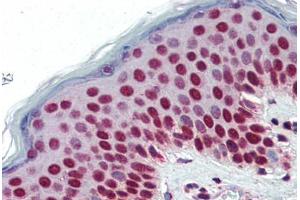 Human Skin (formalin-fixed, paraffin-embedded) stained with SETD7 antibody ABIN364315 at 5 ug/ml followed by biotinylated anti-mouse IgG secondary antibody ABIN481714, alkaline phosphatase-streptavidin and chromogen. (SETD7 抗体)