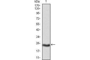 Western blot analysis using PKHD1 mAb against mouse PKHD1(AA: 3878-4060) recombinant protein.