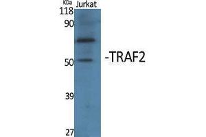 Western Blotting (WB) image for anti-TNF Receptor-Associated Factor 2 (TRAF2) (Internal Region) antibody (ABIN3187320) (TRAF2 抗体  (Internal Region))