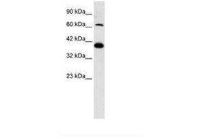 Image no. 2 for anti-Glutamate Receptor, Ionotropic, Kainate 2 (GRIK2) (AA 151-200) antibody (ABIN202320) (GRIK2 抗体  (AA 151-200))