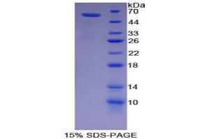 SDS-PAGE analysis of Pig Lipase, Hepatic Protein. (LIPC 蛋白)