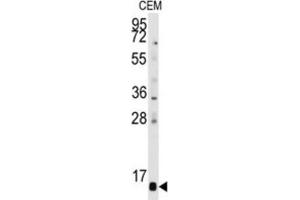 Western Blotting (WB) image for anti-Prefoldin Subunit 6 (PFDN6) antibody (ABIN3001660) (PFDN6 抗体)