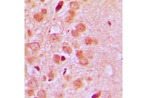 Immunohistochemical analysis of CD75 staining in human brain formalin fixed paraffin embedded tissue section. (ST6GAL1 抗体  (Center))