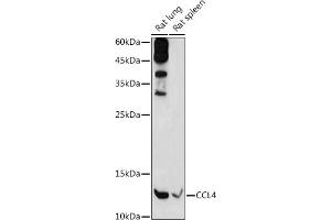 Western blot analysis of extracts of various cell lines, using CCL4 antibody (ABIN3022366, ABIN3022367, ABIN3022368 and ABIN6218763) at 1:1000 dilution. (CCL4 抗体  (C-Term))