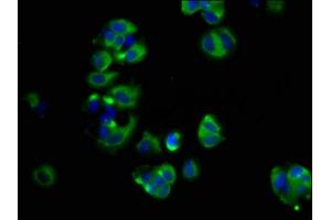 Immunofluorescence staining of MCF-7 cells with ABIN7166124 at 1:66, counter-stained with DAPI. (SHROOM2 抗体  (AA 213-405))