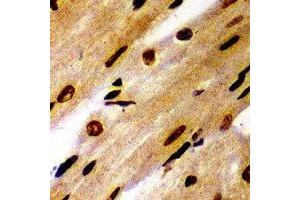 Immunohistochemistry (IHC) image for anti-Proteasome (Prosome, Macropain) Subunit, beta Type, 1 (PSMB1) antibody (ABIN7305904)