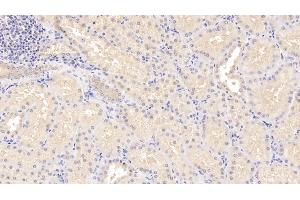 Detection of STC1 in Human Kidney Tissue using Polyclonal Antibody to Stanniocalcin 1 (STC1) (Stanniocalcin 1 抗体  (AA 28-247))