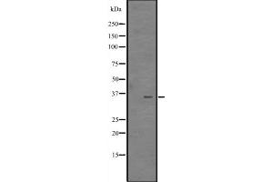 Western blot analysis of CITED4 expression in MCF7 Cell Lysate ,The lane on the left is treated with the antigen-specific peptide.